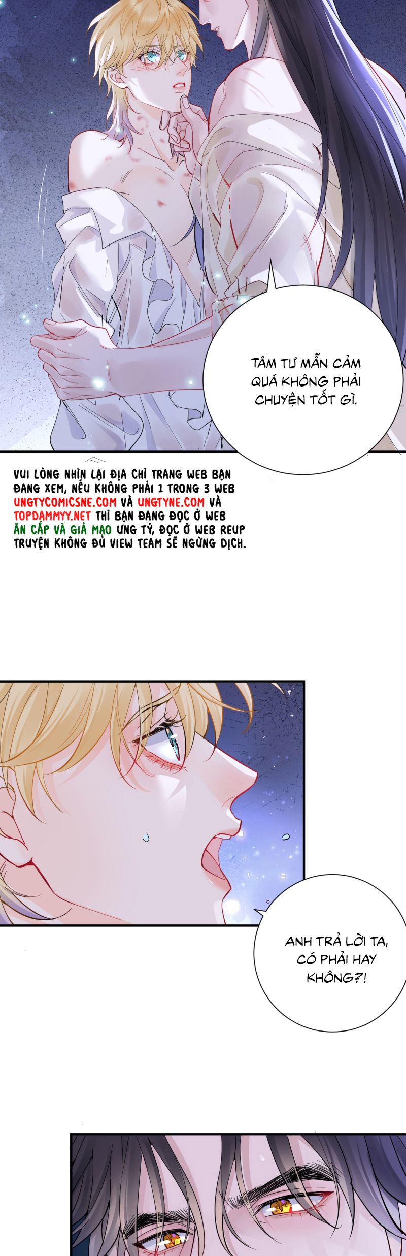 Bản Tình Ca Nụ Hôn Tù Ái Chap 35 - Next 